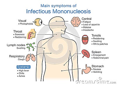 Symptoms of Infectious Mononucleosis disease. Vector Illustration