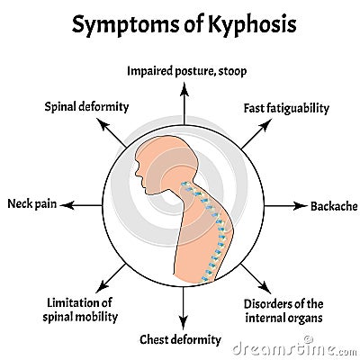 Symptoms of kyphosis. Spinal curvature, kyphosis, lordosis, scoliosis, arthrosis. Improper posture and stoop Vector Illustration