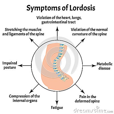 Symptoms of lordosis. Spinal curvature, kyphosis, lordosis, scoliosis, arthrosis. Improper posture and stoop Vector Illustration