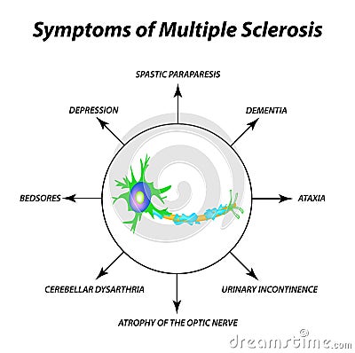 Symptoms of multiple sclerosis. The destruction of the myelin sheath on the axon. Damaged myelin. World Multiple Vector Illustration