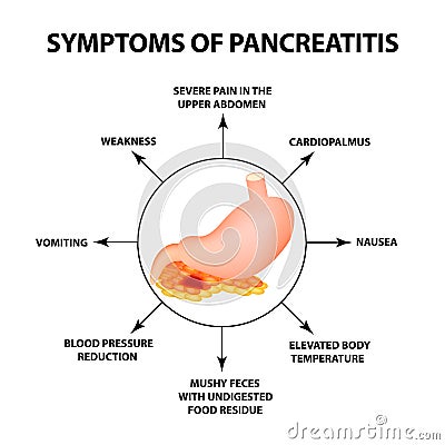 Symptoms of pancreatitis. The structure of the stomach and pancreas. Infographics. Vector illustration on isolated Vector Illustration