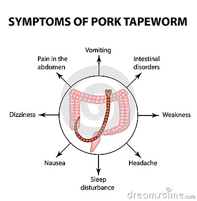 Symptoms of Pork tapeworm. Infographics. Vector illustration on background Vector Illustration