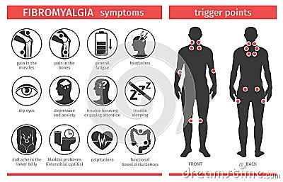 Symptoms and signs of fibromyalgia. Tender points. Infographic. Template for use in medical agitation. Vector Vector Illustration