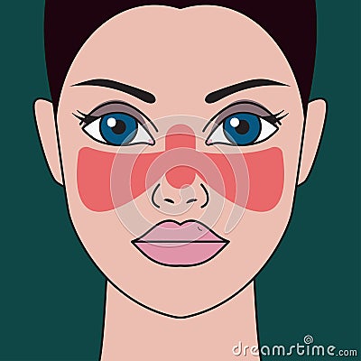 Systemic lupus erythematosus Vector Illustration