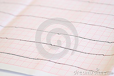 Tape ECG with ventricular asystole Stock Photo