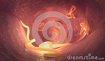 Tapeworm infestation in a human intestine Cartoon Illustration