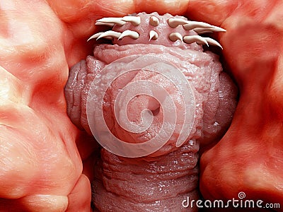 Tapeworm head attached to the intestine Stock Photo