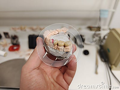 Technician dental is working with complete metal ceramic prosthesis dental. Stock Photo