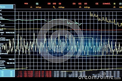 Oscilloscope waveform on its screen. Generative AI Stock Photo