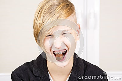 Teen with braces on his teeth eats chocolate. Stock Photo