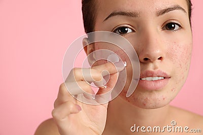 Teen girl applying acne healing patch on pink background Stock Photo