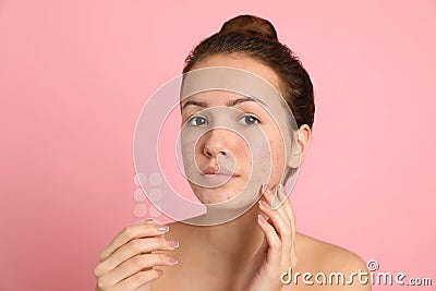 Teen girl holding acne healing patches on pink background Stock Photo
