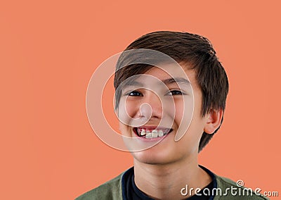 Teenager boy with diastema overbite teeth missing gap wearing orthodontic appliance treatment. Dental braces with child concept. Stock Photo