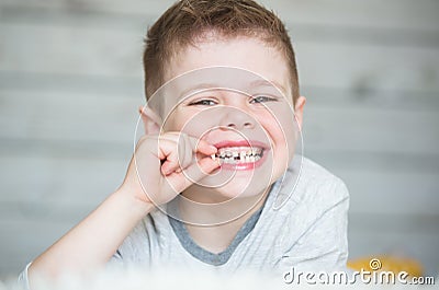 Teenager child with a tooth dropped out Stock Photo