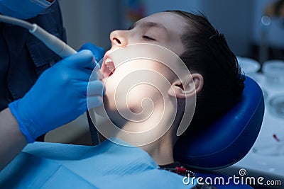 A teenager with an open mouth in dentistry at a dentist`s appointment. Dental treatment. Stock Photo