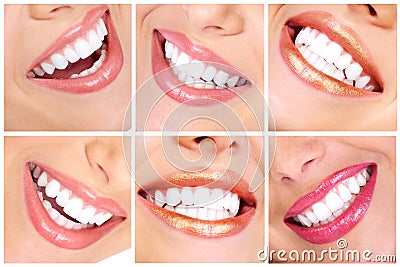 Teeth Stock Photo