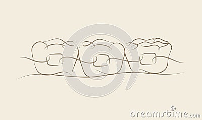 Teeth braces illustration beige color Vector Illustration