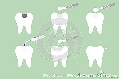 Step of caries to tooth amalgam filling with dental tools Vector Illustration