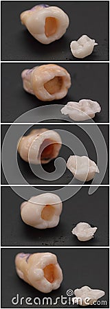 Teeth collage Stock Photo