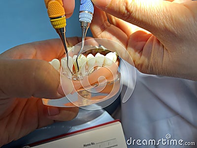 Teeth model. dental study model on dentist hand. jaw in cabinet of dental clinic. Stock Photo