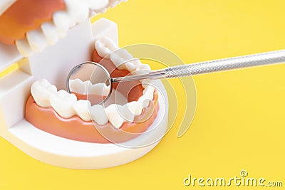 The Teeth model showing an implant dental demonstration teeth study teach model on yellow background Stock Photo