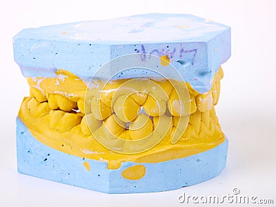 Teeth plaster cast Stock Photo