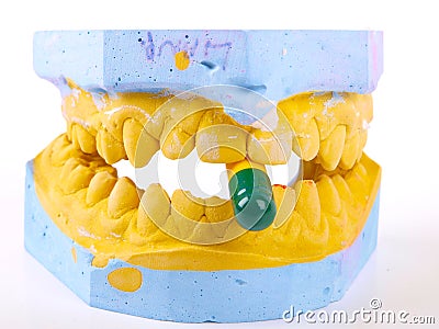 Teeth plaster cast Stock Photo