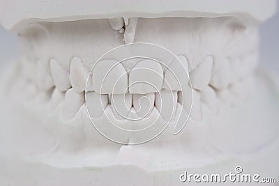 Teeth plaster cast Stock Photo