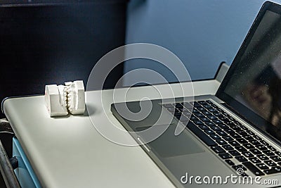 teeth plaster cast near laptop Stock Photo