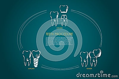 Teeth procedure - crown, veneer, implant vector concept set Cartoon Illustration
