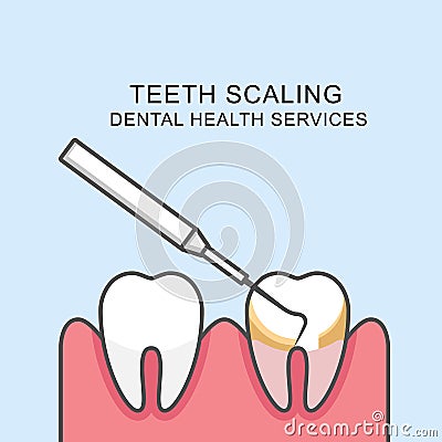 Teeth scaling icon - cleaning tooth with periodontal probe Vector Illustration