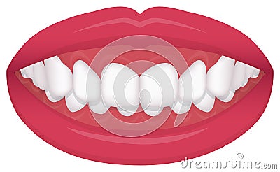 Teeth trouble bite type / crooked teeth vector illustration /Deep bite Vector Illustration