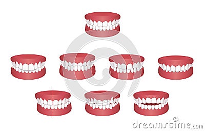 Teeth trouble bite type vector illustration set Vector Illustration