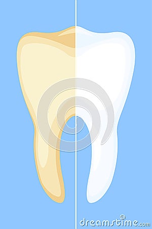 Teeth whitening concept. Vector Illustration