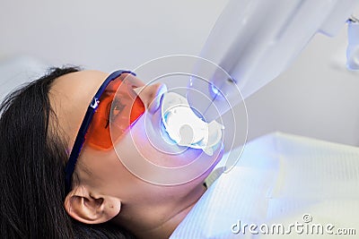 Teeth whitening on lamp ultravioleta. The girl on reception at the dentist for teeth whitening. The concept of dental care Stock Photo