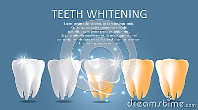 Teeth whitening vector medical poster banner template Vector Illustration