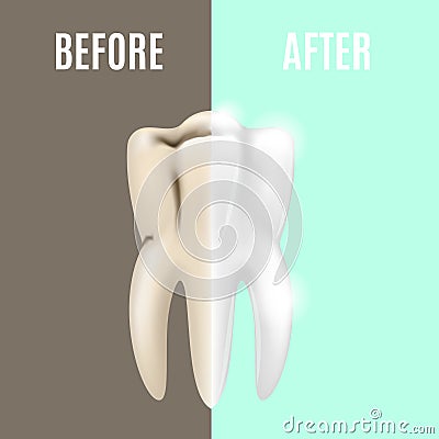 Teeth Whitening Before and After. Vector Vector Illustration