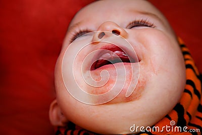 Teething Baby With Drool Rash Stock Photo