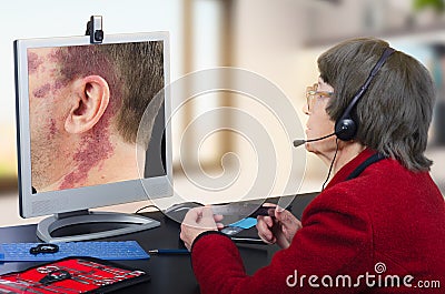 Telemedicine dermatologist looking at big birthmark Stock Photo