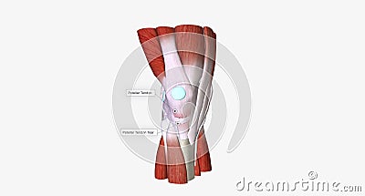 When a tendon is weakened by age or overuse, trauma can cause it to rupture Stock Photo