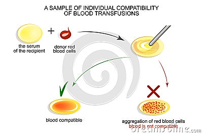 The test on individual blood compatibility Vector Illustration
