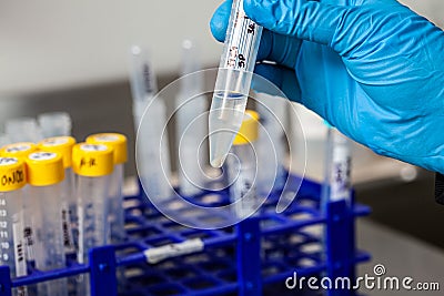 Test tube with blood cells pellet obtained after several washes and centrifugation Stock Photo