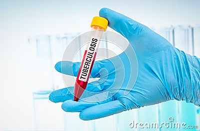 Test-tube with blood sample for TUBERCULOSIS test Stock Photo