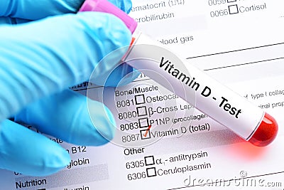 Vitamin D test Stock Photo