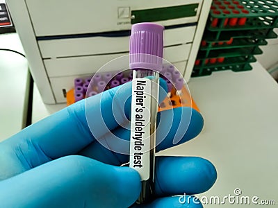 Napiers aldehyde test Stock Photo