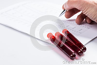 Test tubes with blood Stock Photo