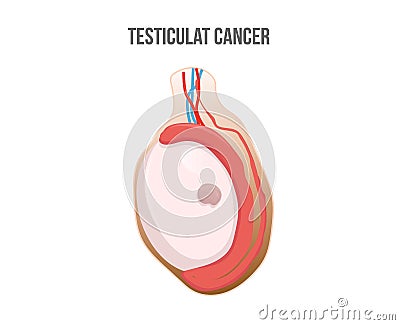 Testicular cancer vector illustration Vector Illustration