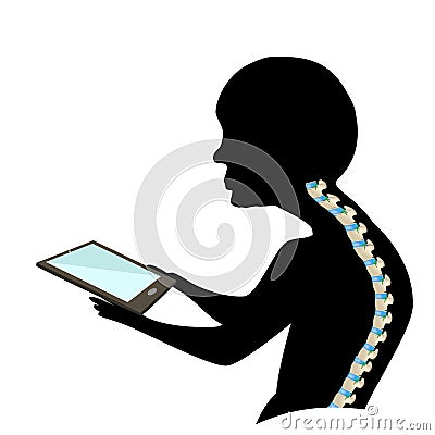 Text Neck Syndrome. Spinal curvature, kyphosis, lordosis of the neck, scoliosis, arthrosis. Improper posture and stoop Vector Illustration