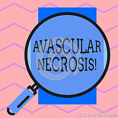 Text sign showing Avascular Necrosis. Conceptual photo death of bone tissue due to a lack of blood supply Round Stock Photo