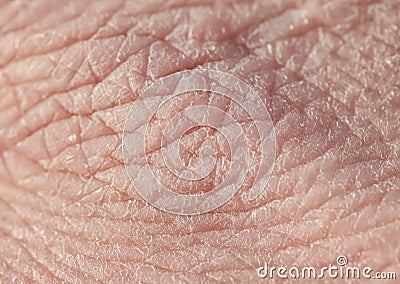 Texture of pink weather-beaten human hand skin covered with deep wrinkles and dry scales Stock Photo